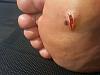 foot.jpg